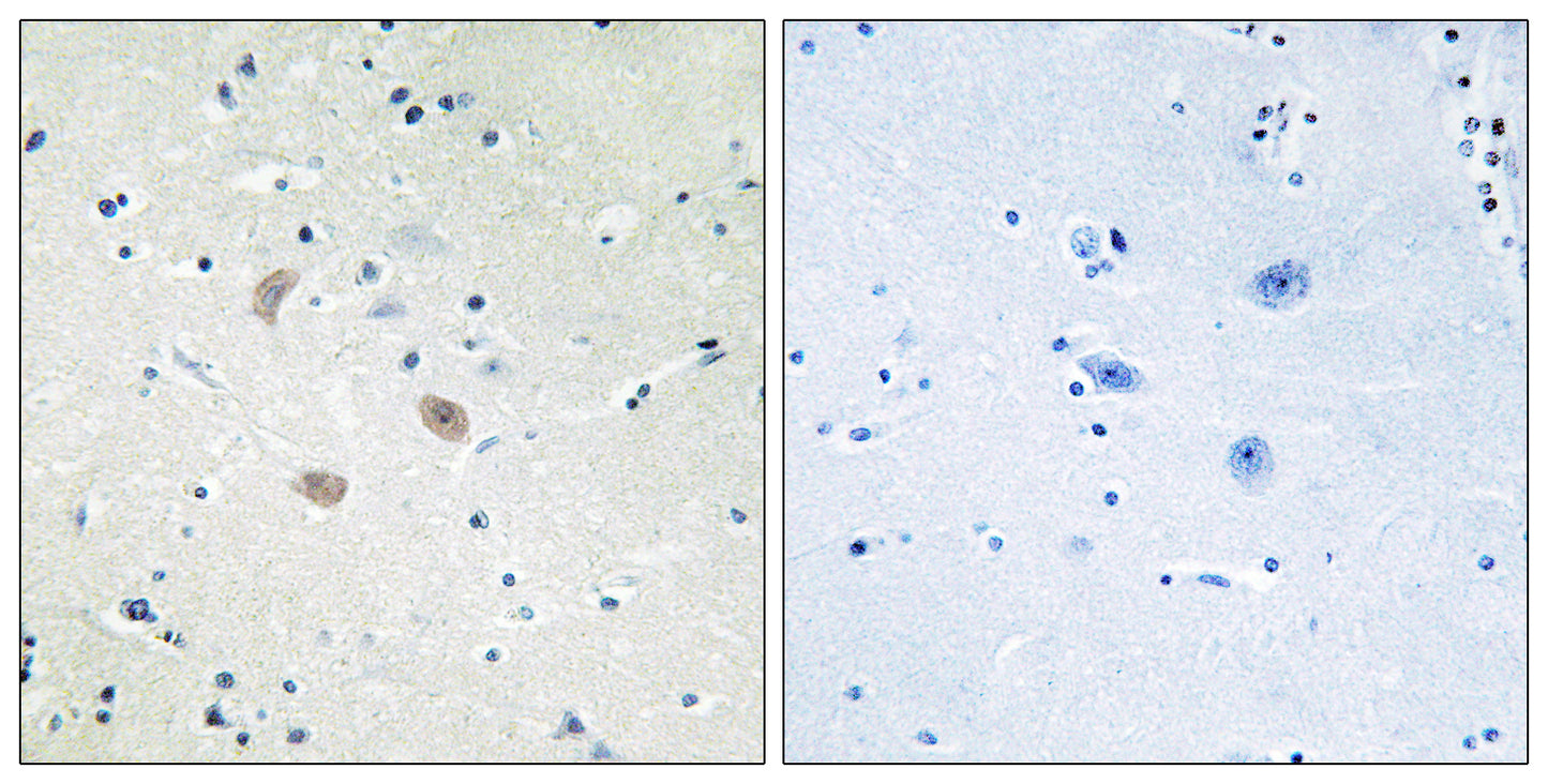 Akt2 Rabbit Polyclonal Antibody