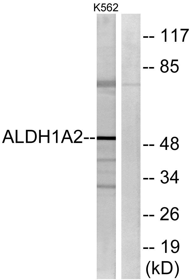 ALDH1A2 Rabbit Polyclonal Antibody