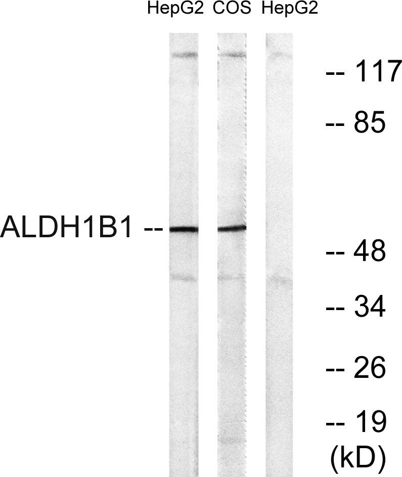 ALDH1B1 Rabbit Polyclonal Antibody