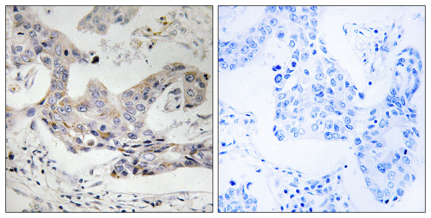 ALDH3B1 Rabbit Polyclonal Antibody