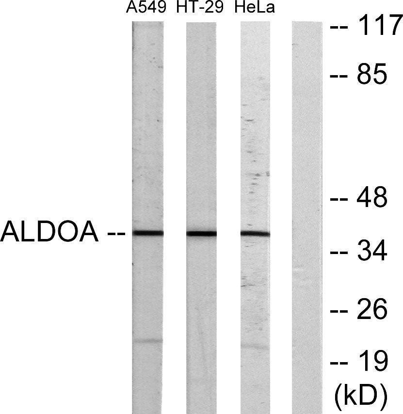 Aldolase A Rabbit Polyclonal Antibody