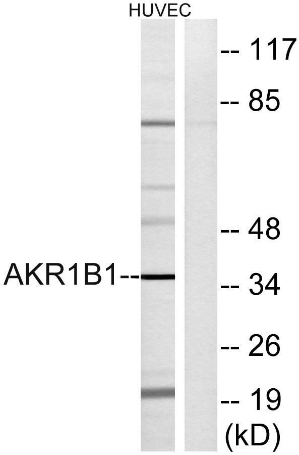 Aldose Reductase Rabbit Polyclonal Antibody