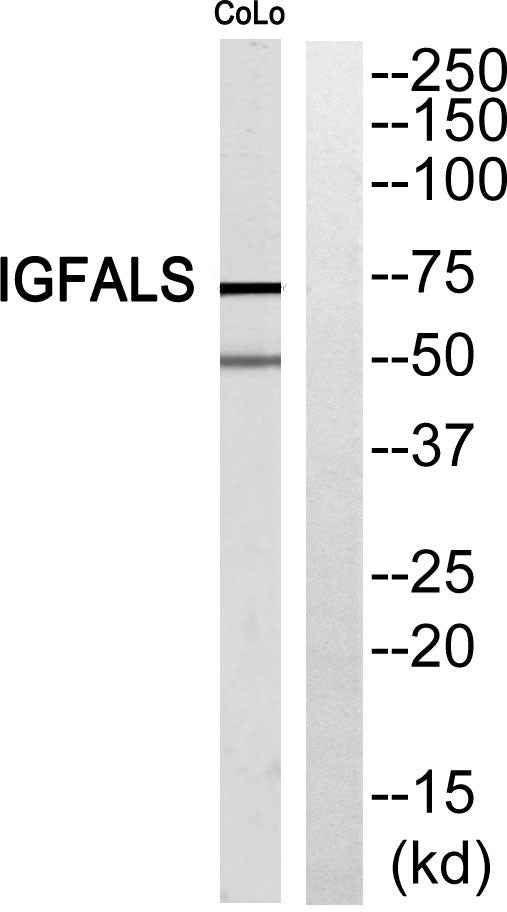 ALS Rabbit Polyclonal Antibody
