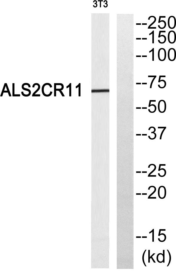 ALS2CR11 Rabbit Polyclonal Antibody