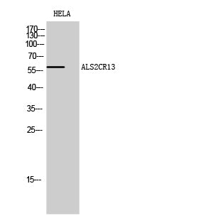 ALS2CR13 Rabbit Polyclonal Antibody