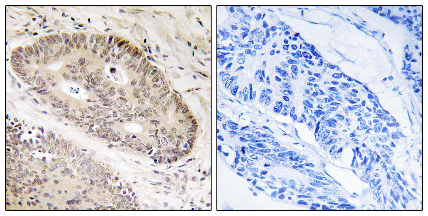 ALS2CR8 Rabbit Polyclonal Antibody