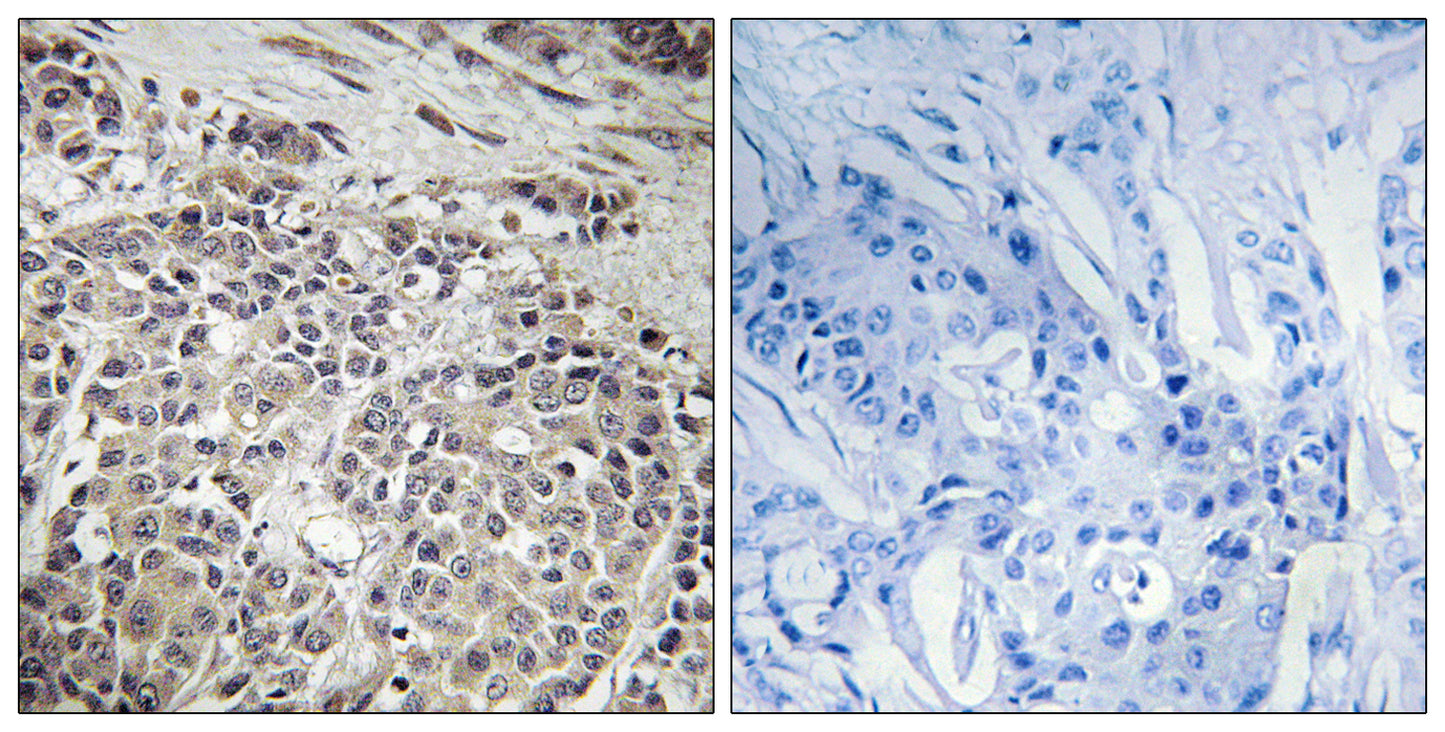 AMPKα1 Rabbit Polyclonal Antibody