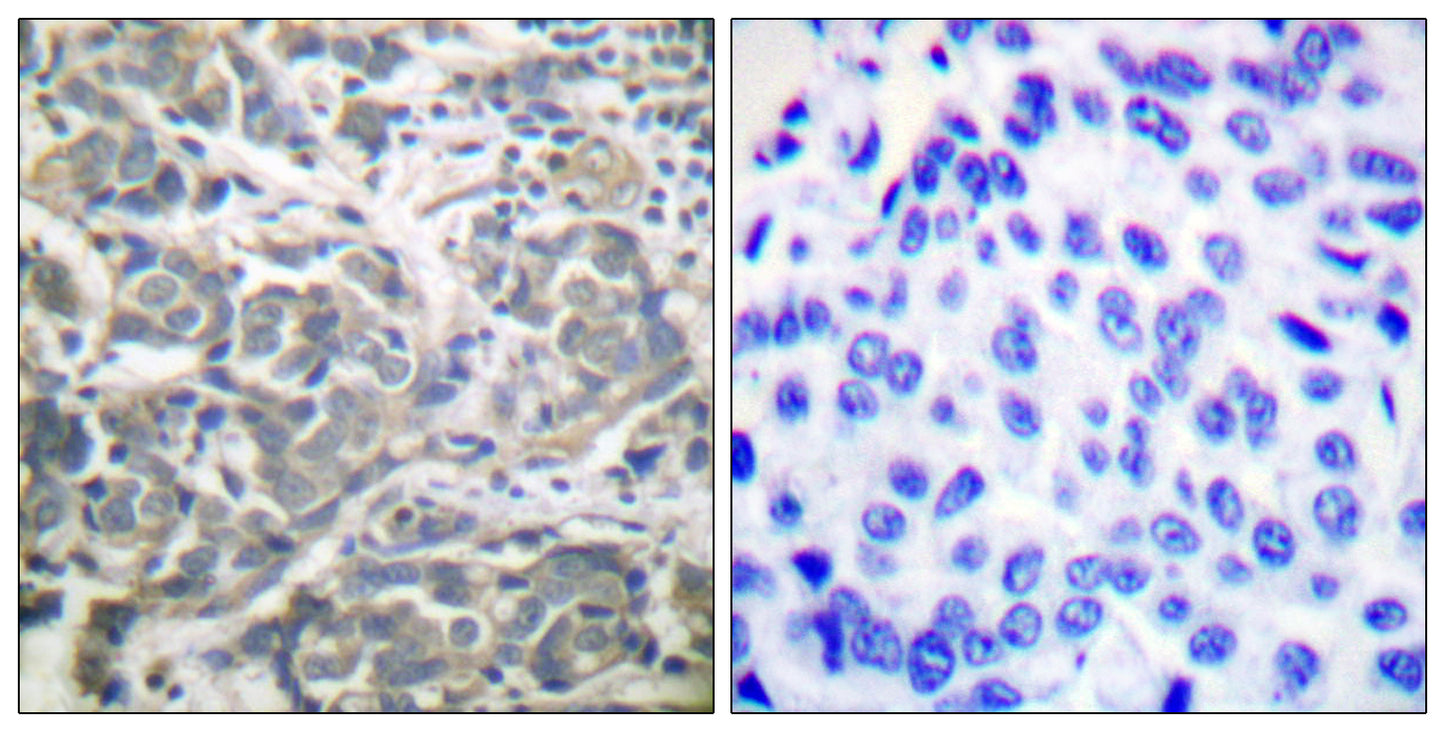 AMPKα1/2 Rabbit Polyclonal Antibody