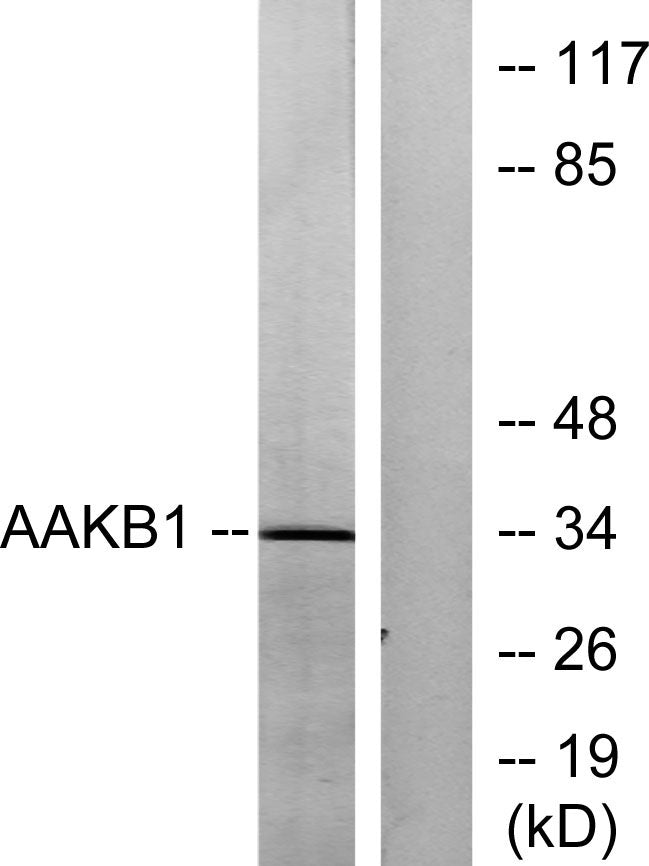 AMPKβ1 Rabbit Polyclonal Antibody
