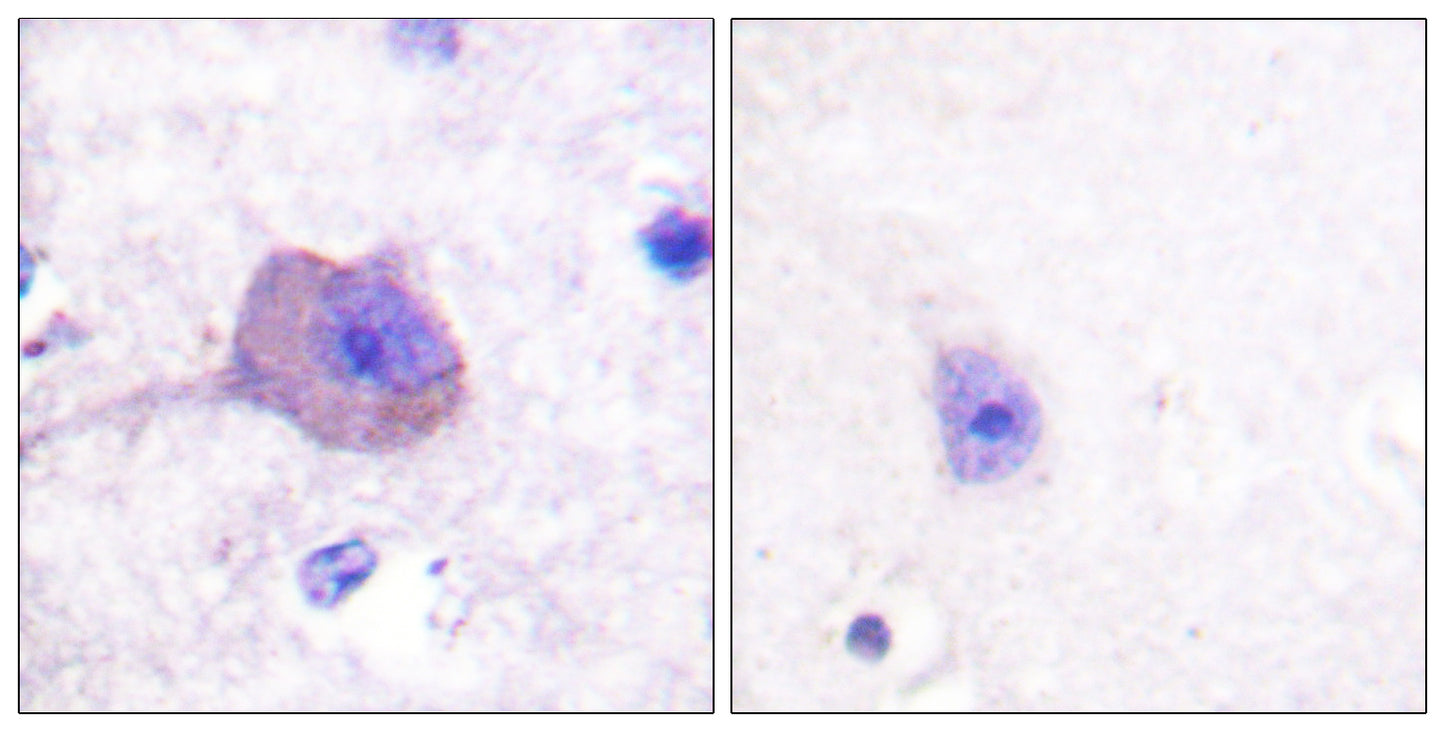 AMPKβ1 Rabbit Polyclonal Antibody