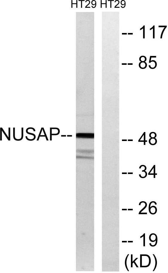 ANKT Rabbit Polyclonal Antibody