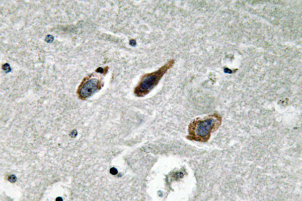 Annexin II Rabbit Polyclonal Antibody