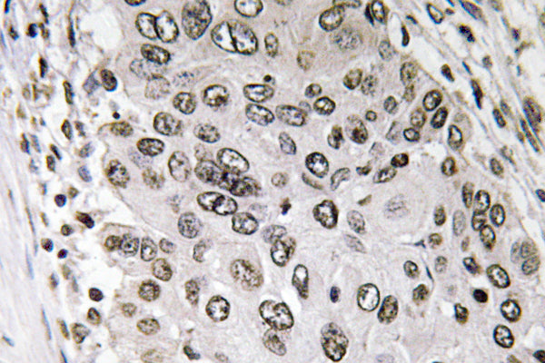 Annexin III Rabbit Polyclonal Antibody