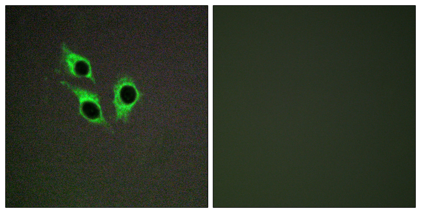 Anoctamin-9 Rabbit Polyclonal Antibody
