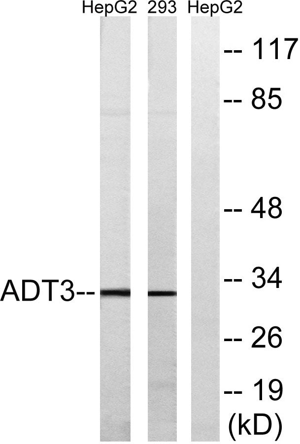 ANT3 Rabbit Polyclonal Antibody
