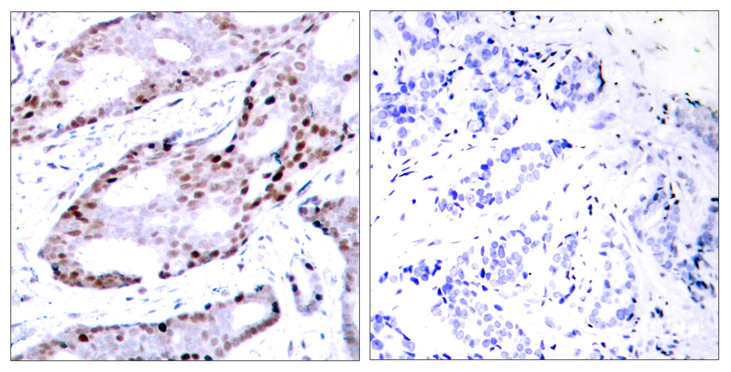 AP-1/Jun D Rabbit Polyclonal Antibody