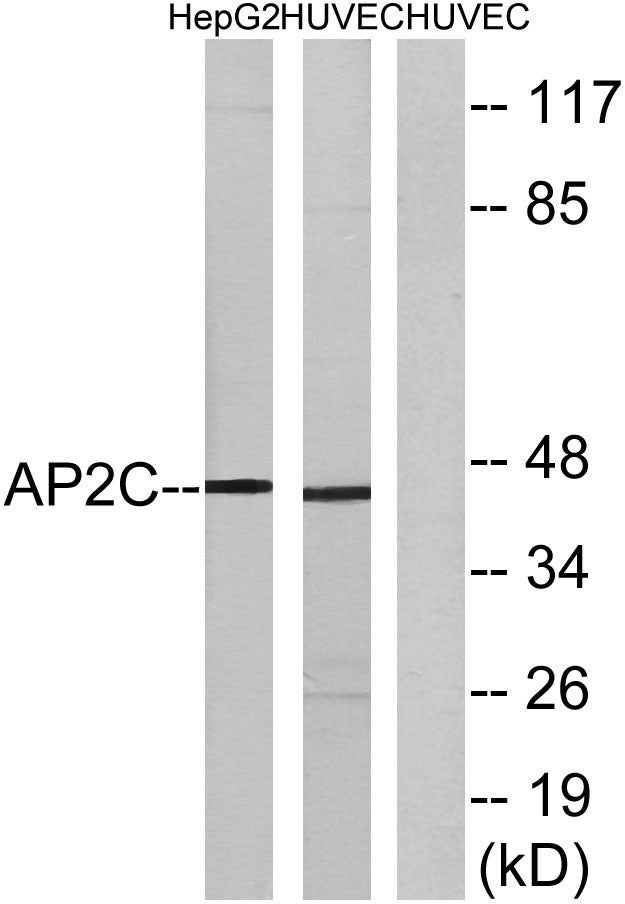AP-2γ Rabbit Polyclonal Antibody