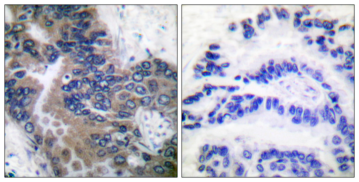 Apaf-1-ALT Rabbit Polyclonal Antibody