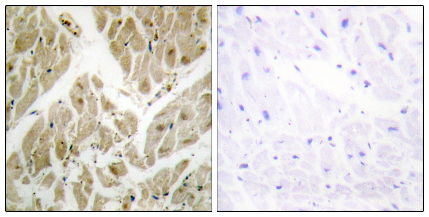 API5 Rabbit Polyclonal Antibody