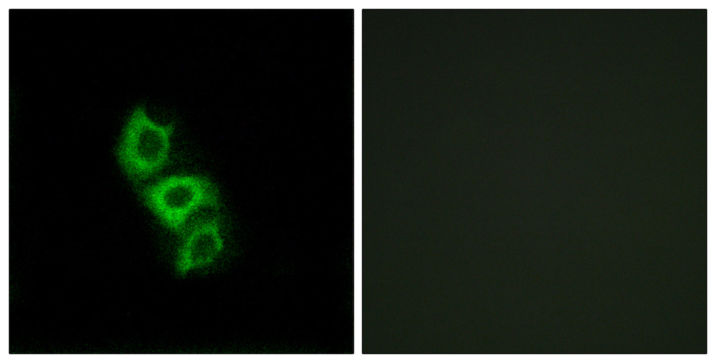 ApoL5 Rabbit Polyclonal Antibody