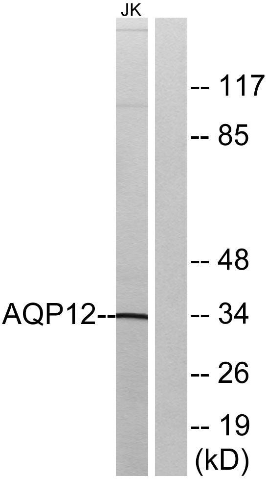 AQP12 Rabbit Polyclonal Antibody