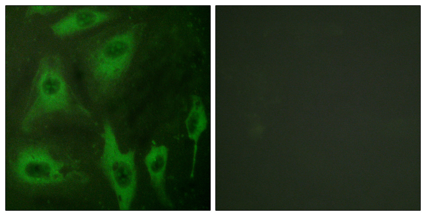 AQP2 Rabbit Polyclonal Antibody