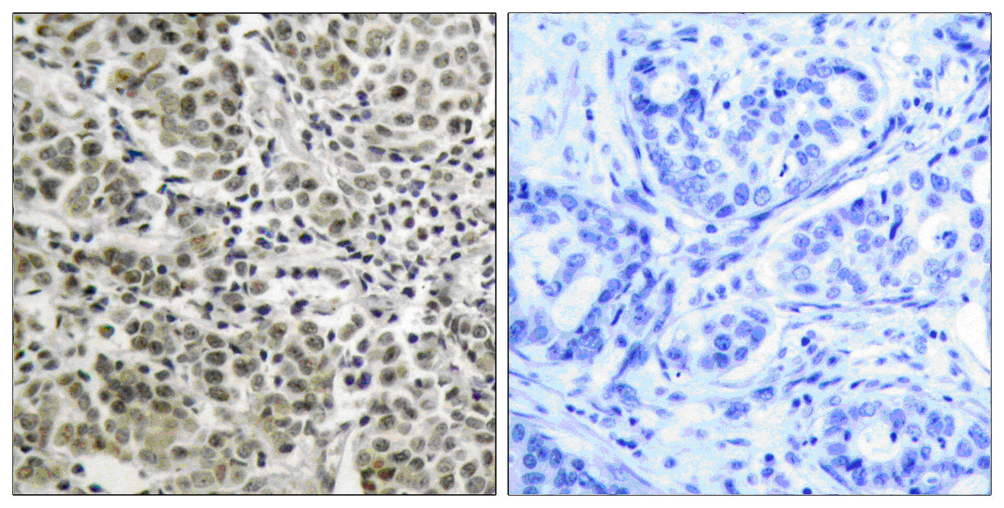 AR Rabbit Polyclonal Antibody