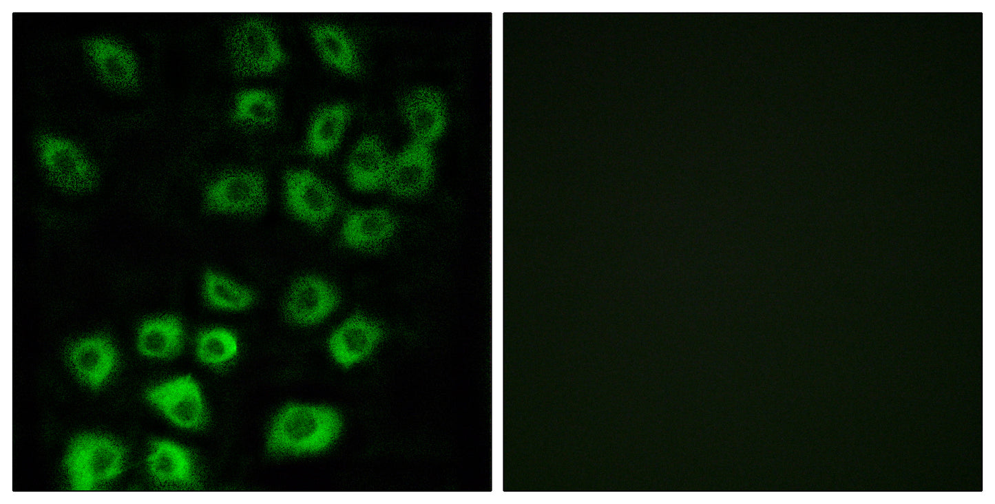 ARF GAP1 Rabbit Polyclonal Antibody