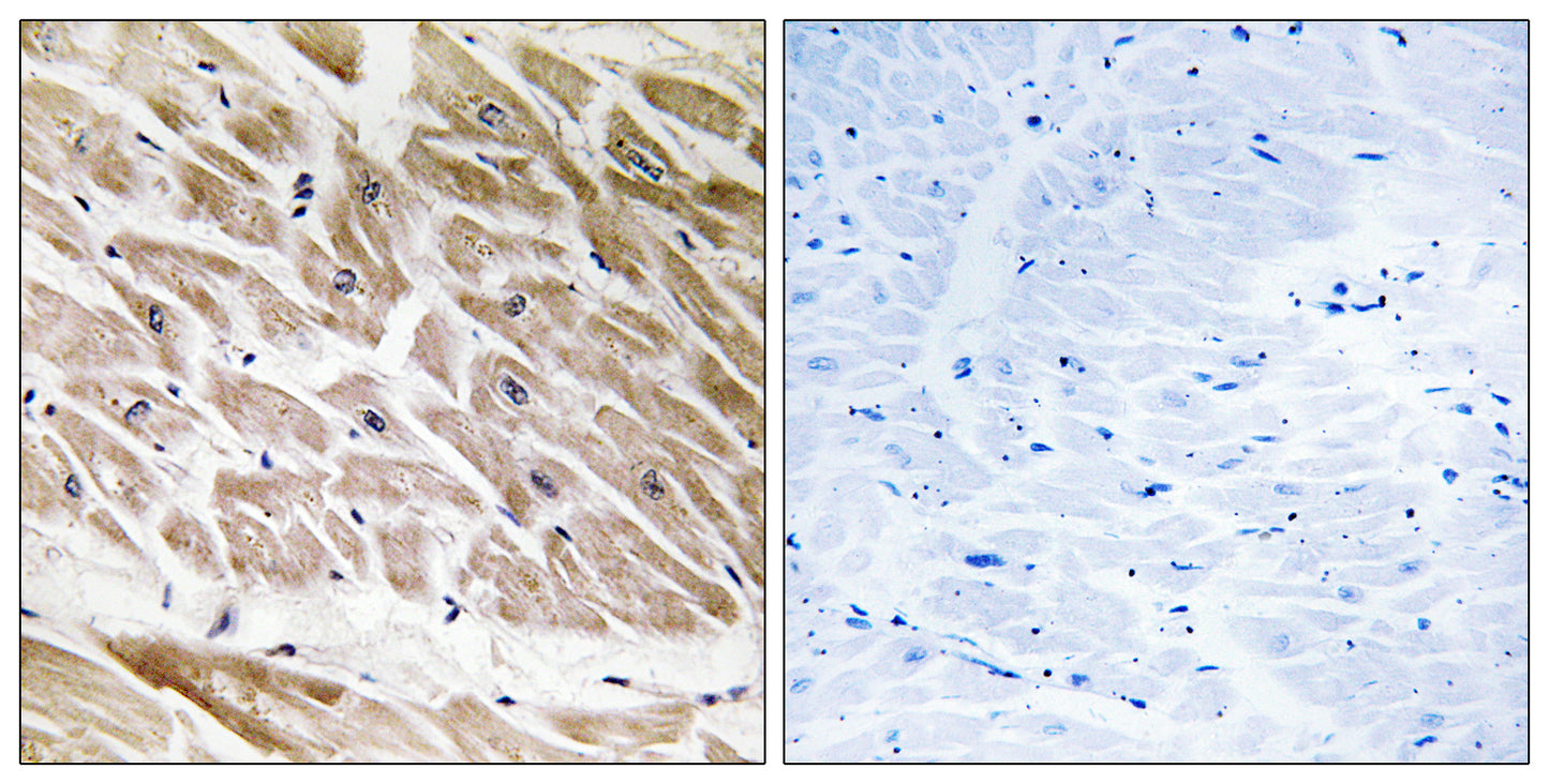 ARHGAP1 Rabbit Polyclonal Antibody