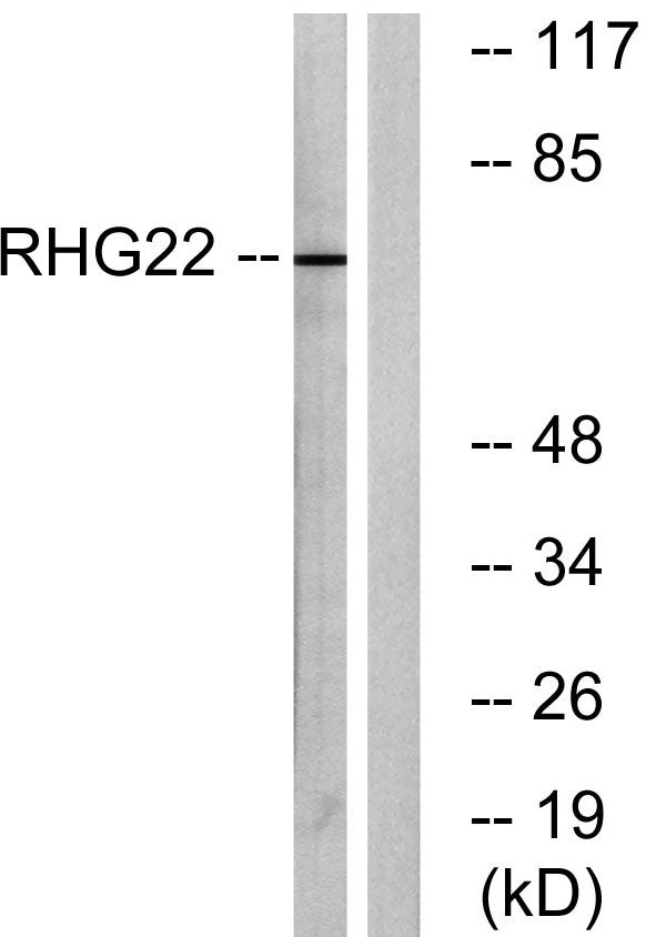 ARHGAP22 Rabbit Polyclonal Antibody