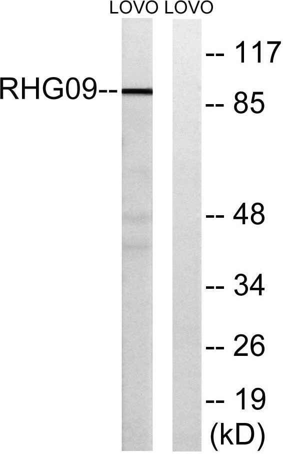 ARHGAP9 Rabbit Polyclonal Antibody