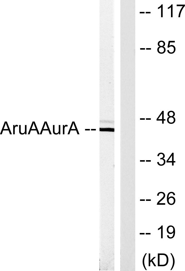 ARK-1 Rabbit Polyclonal Antibody