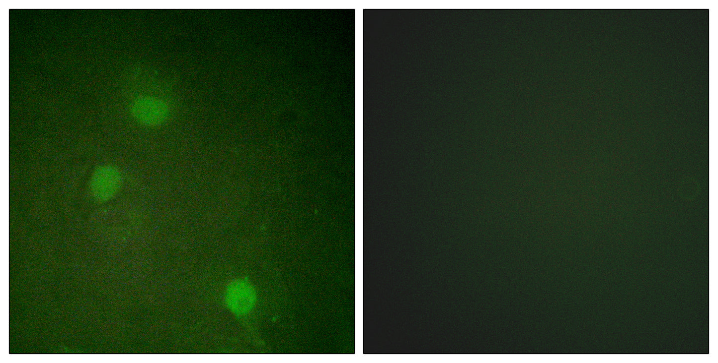 ARK-2 Rabbit Polyclonal Antibody