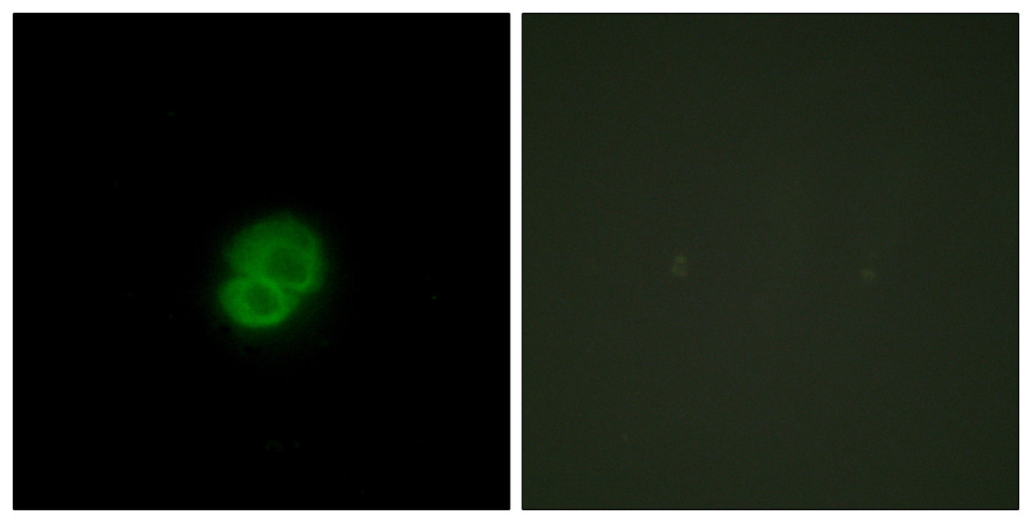 ARMCX2 Rabbit Polyclonal Antibody