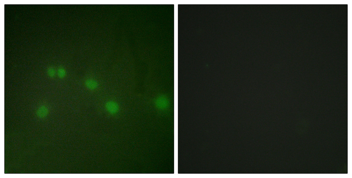 ARP-1 Rabbit Polyclonal Antibody