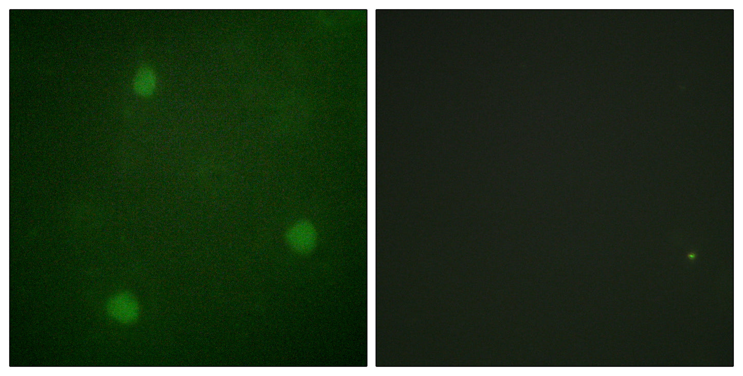 Artemis Rabbit Polyclonal Antibody