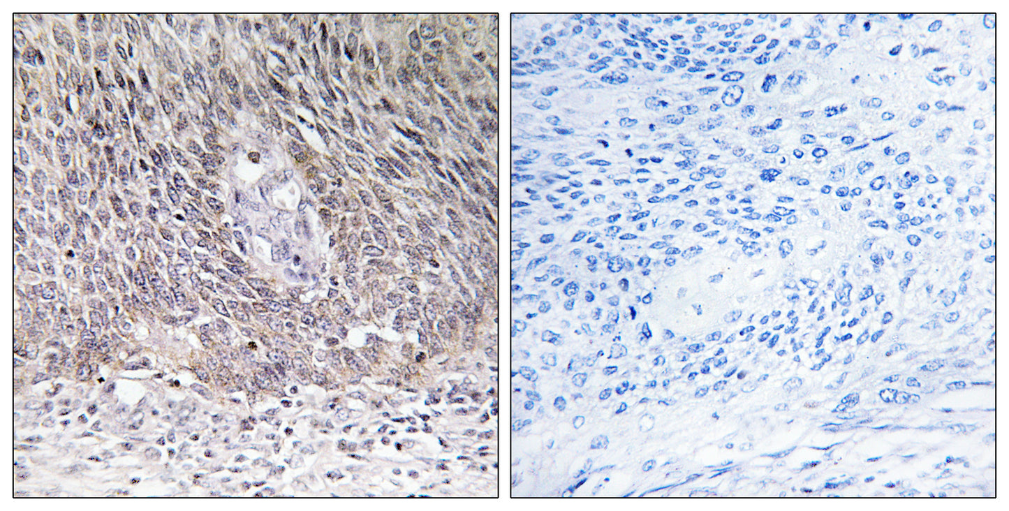 Arylsulfatase A Rabbit Polyclonal Antibody