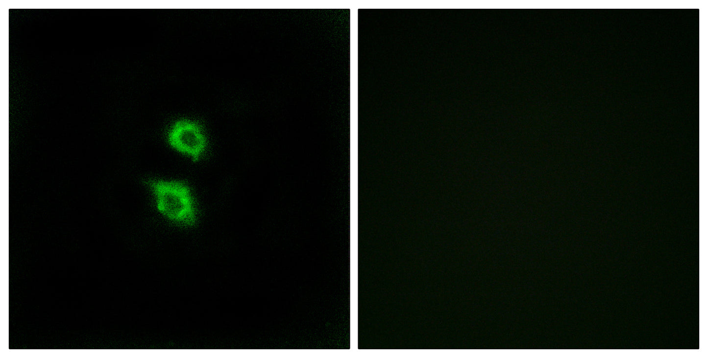 Arylsulfatase D Rabbit Polyclonal Antibody