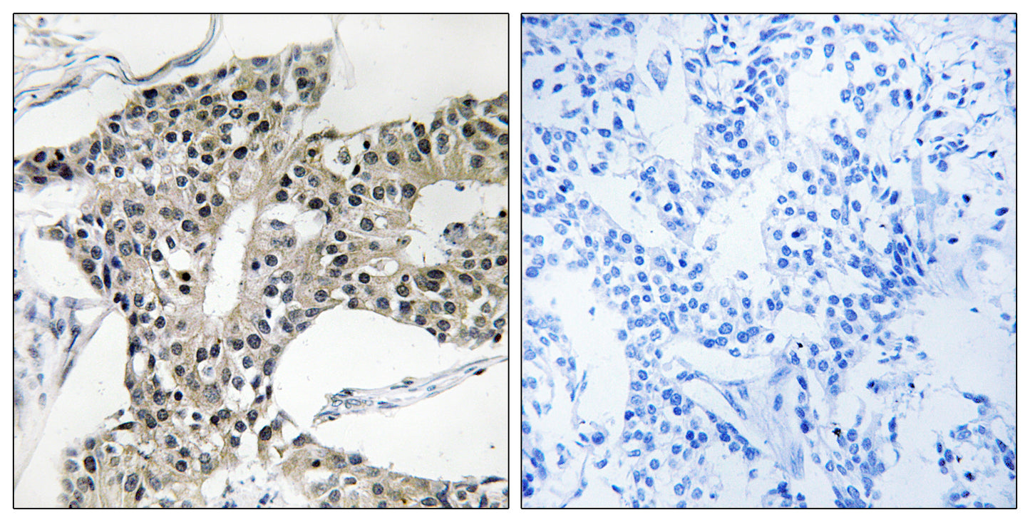 Arylsulfatase K Rabbit Polyclonal Antibody