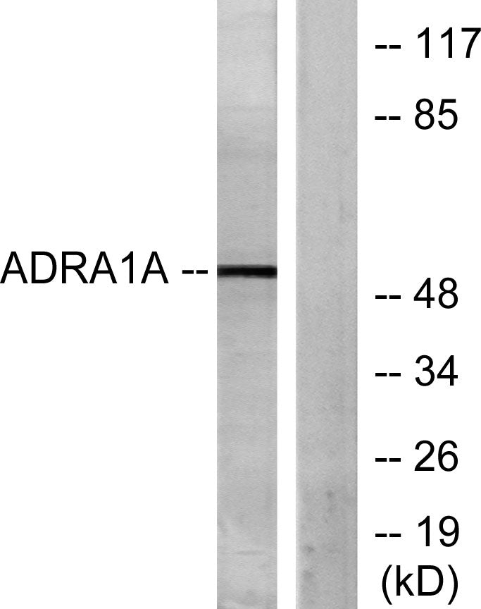 AR-α1A Rabbit Polyclonal Antibody