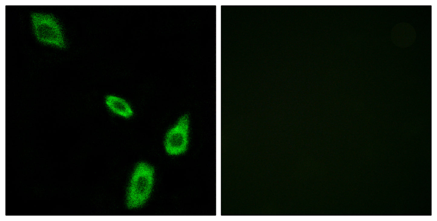 AR-α1B Rabbit Polyclonal Antibody