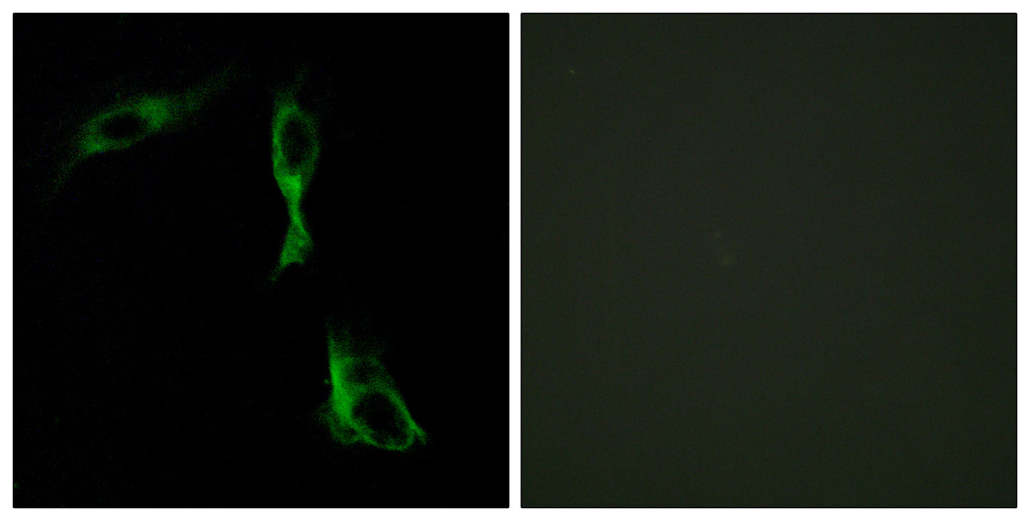 AR-α1D Rabbit Polyclonal Antibody