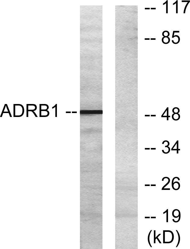 AR-β1 Rabbit Polyclonal Antibody