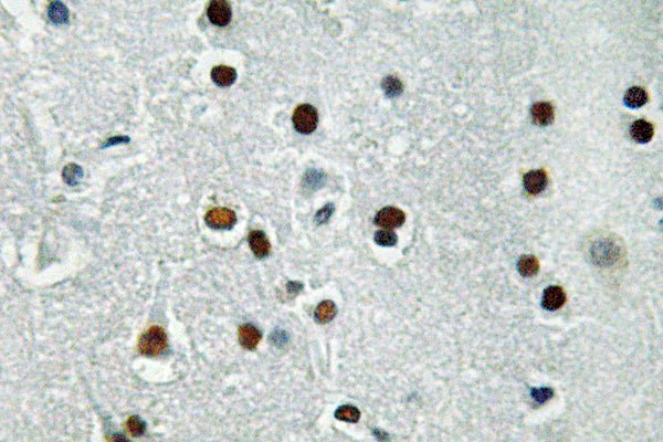 ASCL1 Rabbit Polyclonal Antibody