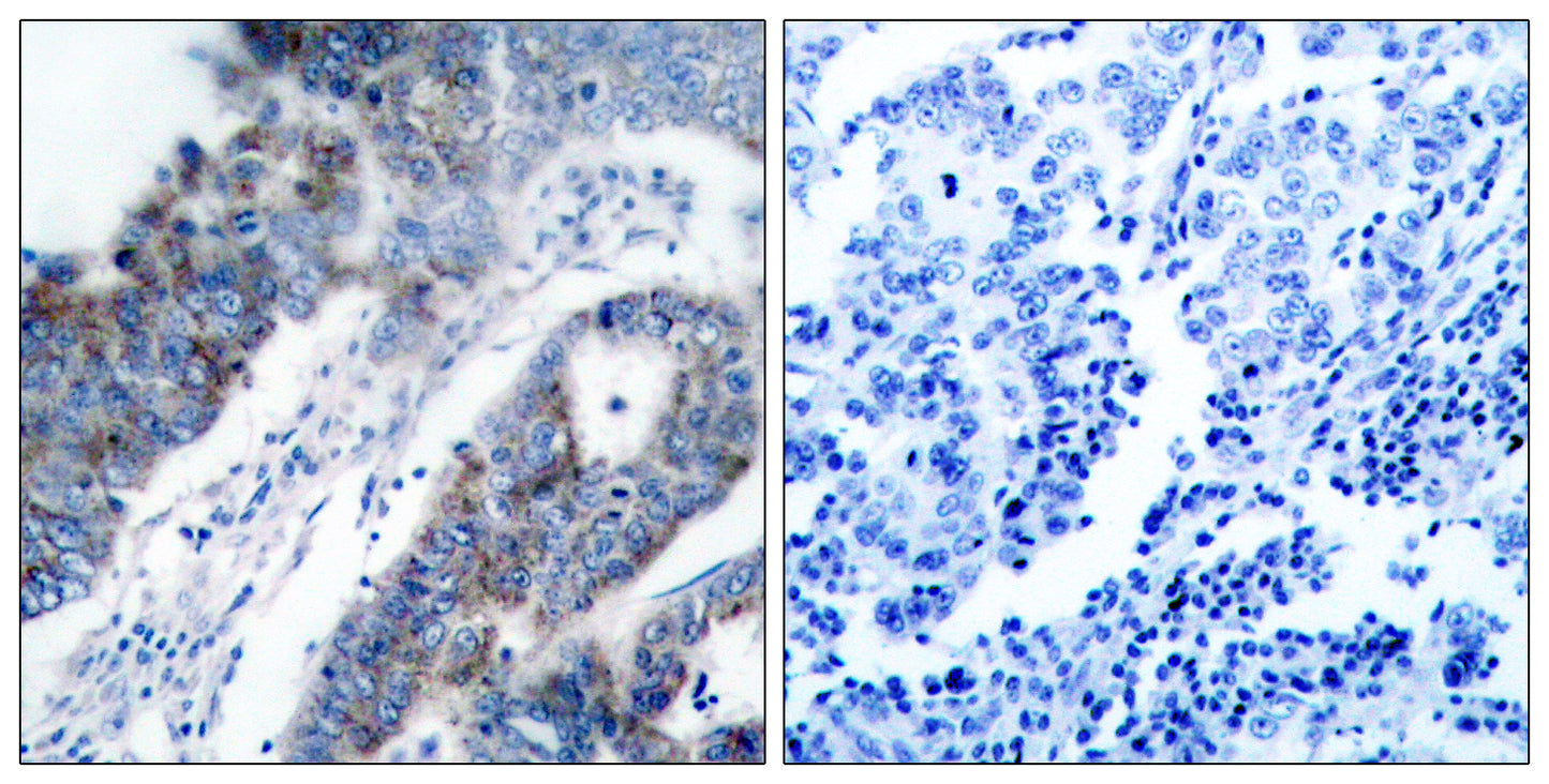 ASK 1 Rabbit Polyclonal Antibody