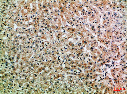 ASPP1 Rabbit Polyclonal Antibody