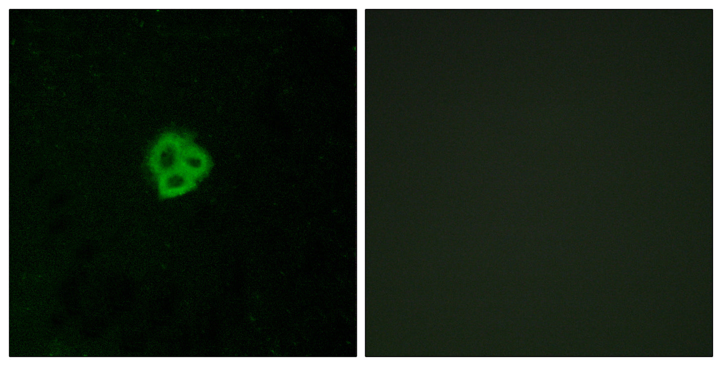 AT1 Rabbit Polyclonal Antibody