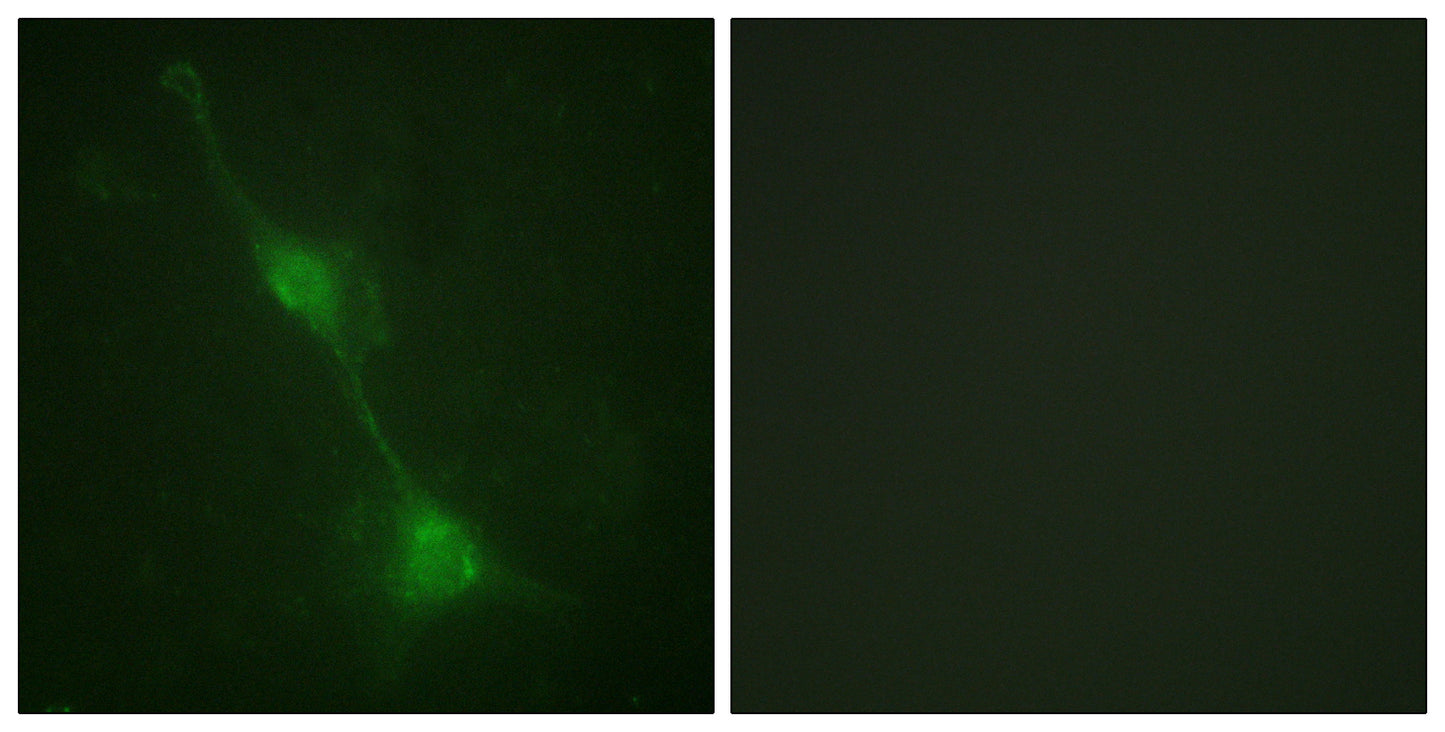 Ataxin-1 Rabbit Polyclonal Antibody