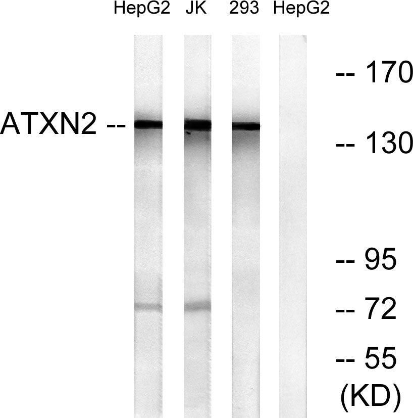 Ataxin-2 Rabbit Polyclonal Antibody