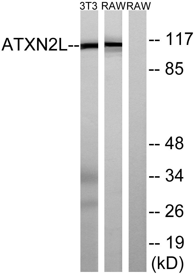 Ataxin-2L Rabbit Polyclonal Antibody